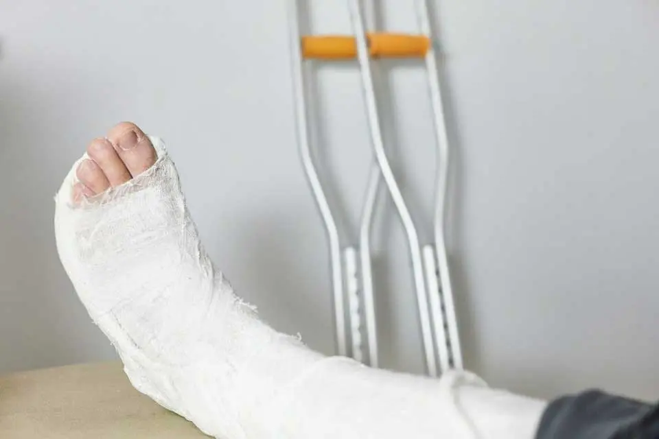 leg-of-a-man-in-a-plaster-cast-close-up-after-an-injury-crutches-in-the-background_t20_dz01B3